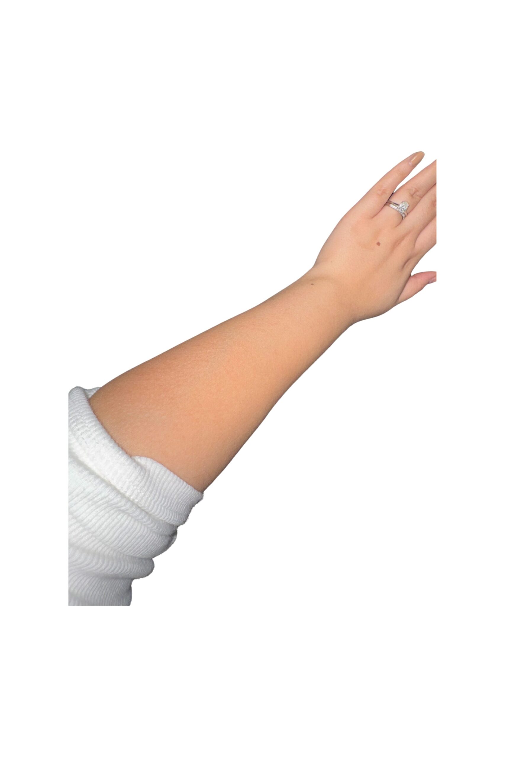 Hair removal Kenzzi IPL results